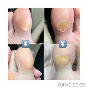 5618A05D-862B-49E1-9E92-FDDAE98080F9