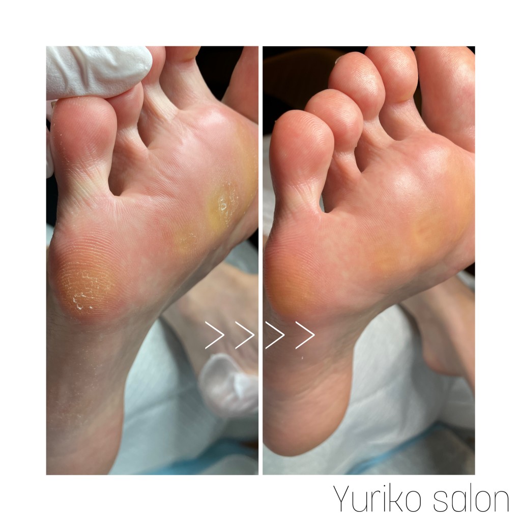 FC7878A2-5E88-44EF-BB5B-ED8DB8F5E2ED