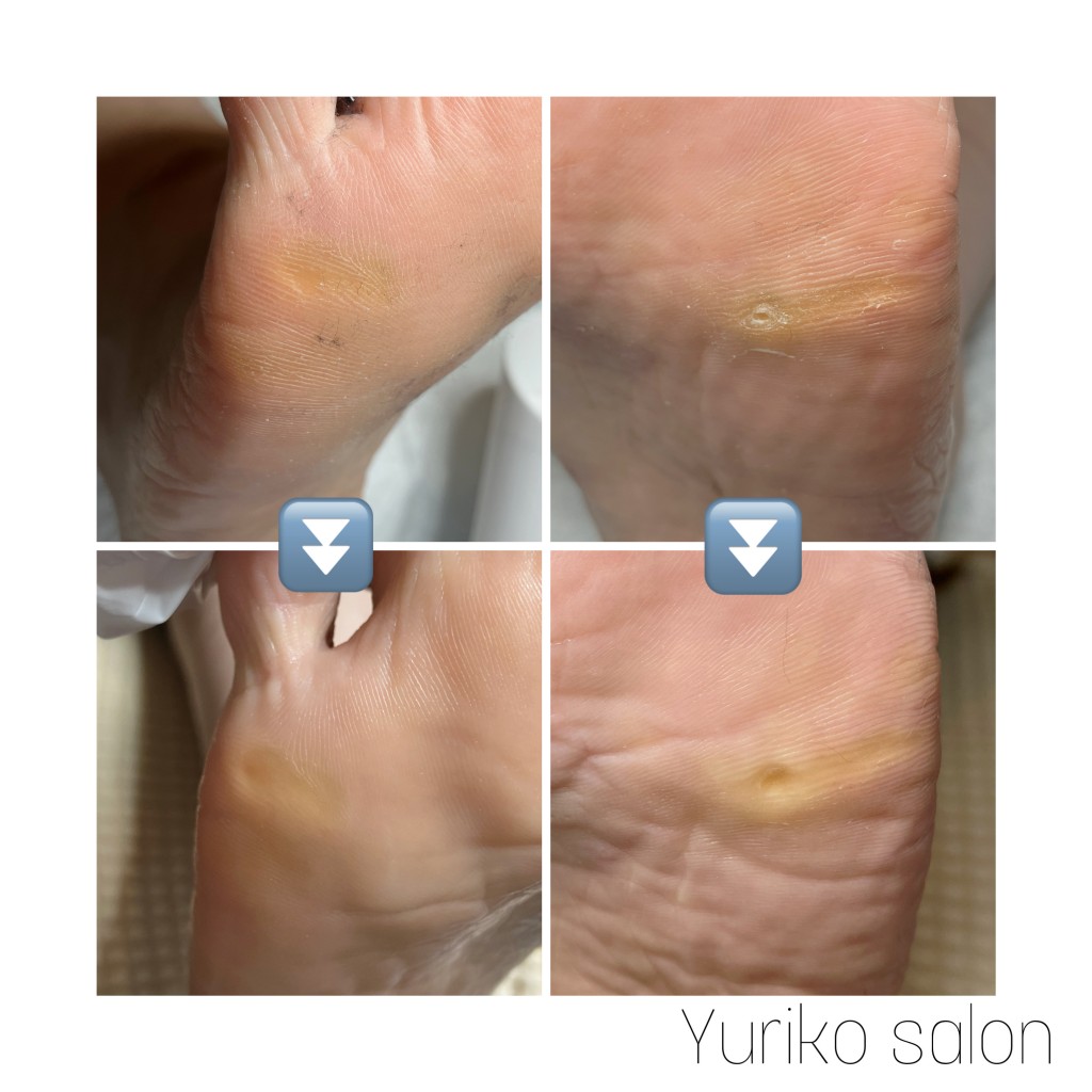 BF004781-FB42-4BA6-B2A9-75B24EDB5FF7